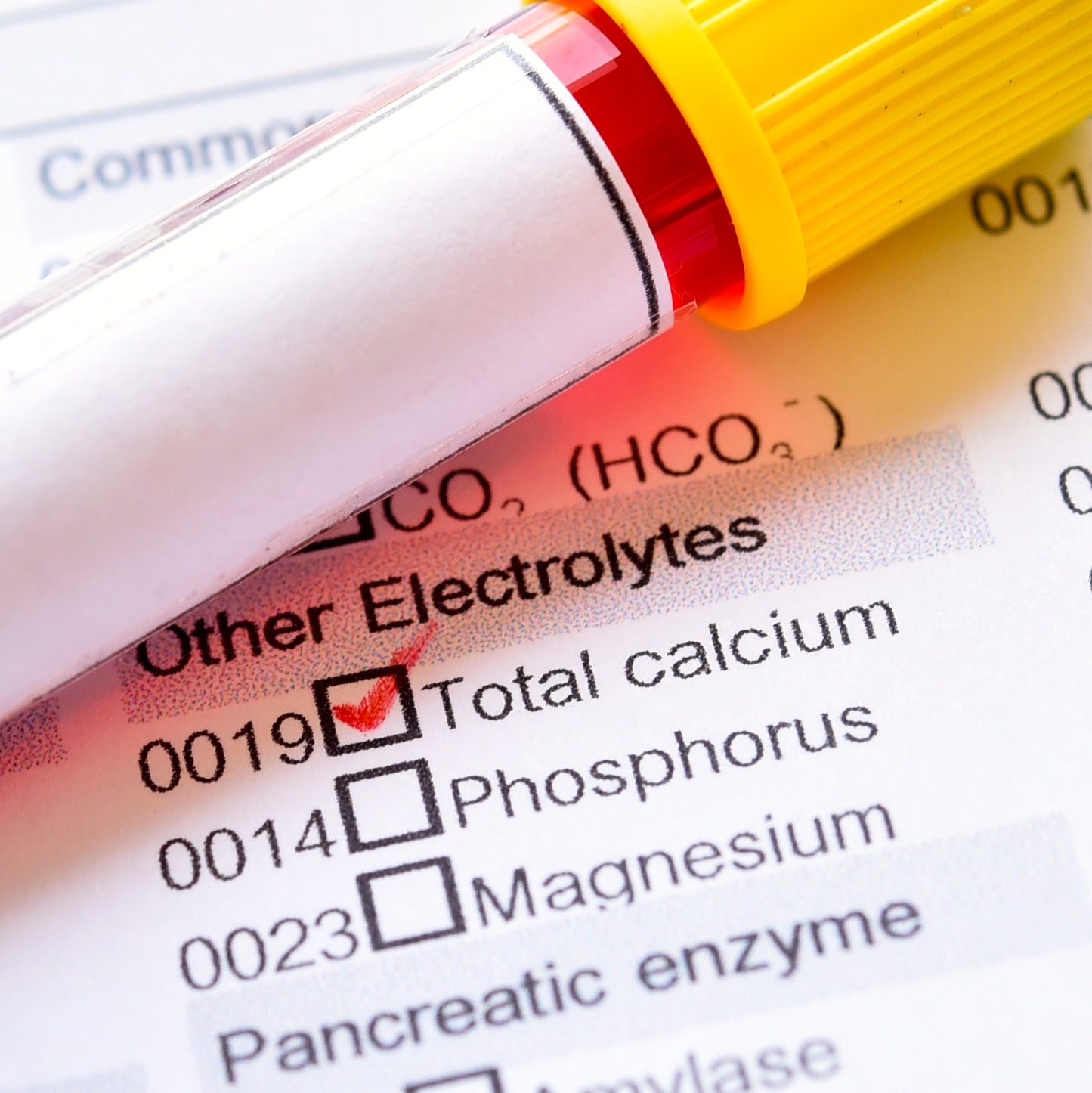 SpectraCell Micronutrient Testing